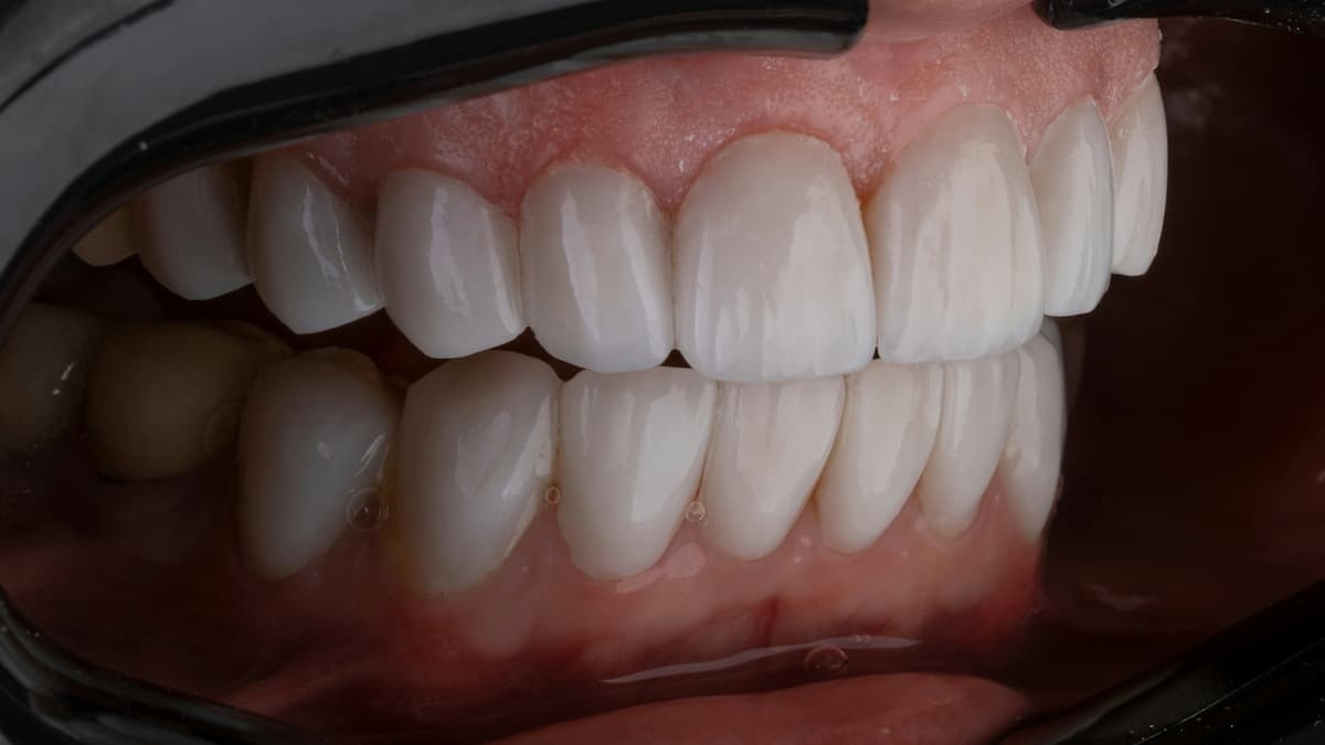 Prevenzione orale: guida completa per evitare l’80% delle malattie dentali