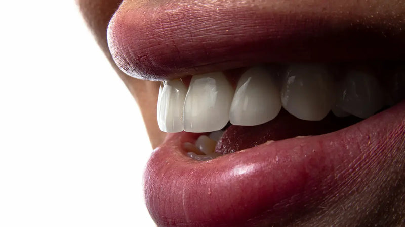 Impianti dentali: costi, durata e come mantenerli